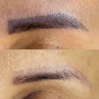 موخوره گیری بدون کوتاهی