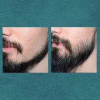 بسازش|آرایشی، بهداشتی، درمانی|زاوه, |دیوار