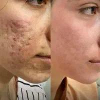 کامل صاف میشه