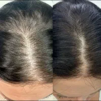 حجم دهی طی دوره کم
