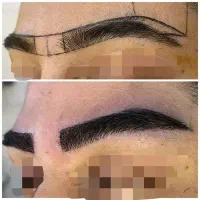 کاشت ابرو طبیعی