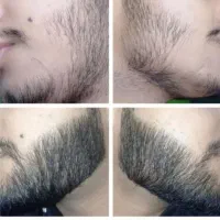 خداحافظی باریش های نخ مانند