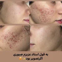 فیشال و خدمات تخصصی پوست توسط پیراپزشک در مطب پزشک