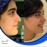 فرصت جراحی زیبایی در مرکز تهران