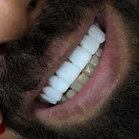 کرایه لاین کامپوزیت