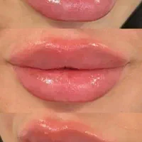 ژل لب|خدمات زیبایی و سلامت|تهران, تهرانسر شرقی|دیوار