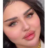 تخفیف تزریق ژل لب و زاویه گونه و ... ۷۸۰