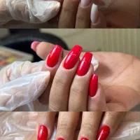 کاشت و ترمیم ناخن/هاشمیه