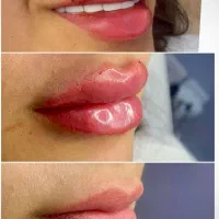 خدمات پزشکی مراقبت پوست و زیبایی بوتاکس،فیلر،مزوژل در مرودشت، ابوذر جنوبی، بلوار هفتم تیر شرقی