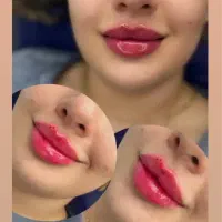 تزریقات تمامی تزریقات