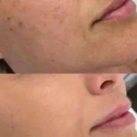 پاکسازی صورت در منزل  رز بیوتی