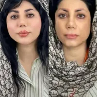 جشنواره/لیفت/جوانسازی/هایفو گلد در ۱ جلسه فقط ۵۵۰ت|خدمات آرایشگری و زیبایی|اصفهان, ناژوان|دیوار