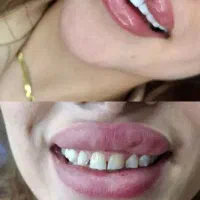 خدمات زیبایی