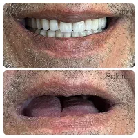 دندان سازی دندانسازی