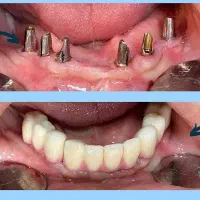نیاز به همکاری با جراح فک صورت
