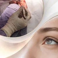 جشنواره ویژه بلفاروپلاستی با تخفیف ویژه