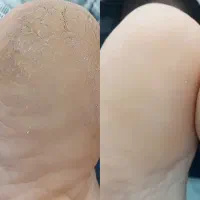 پدیکور و پارافین