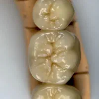 آموزش پرسلن‌گذاری