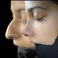 عمل بینی|خدمات آرایشگری و زیبایی|رامشیر, |دیوار