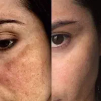 نماینده محصولات بیوممتیک