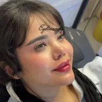 ژل و بوتاکس