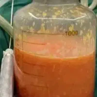 جشنواره تخفیف بزرگ جراحی زیبایی  در مشهد