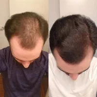 دنبال راهای سخت نباش