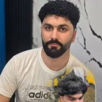 فرم مو با ماندگاری ۶ ماه
