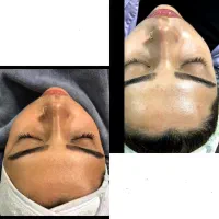 جشنواره تخفیف ویژه ماه رمضان فیشیال تخصصی صورت