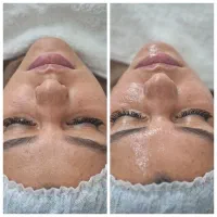 پاکسازی وفیشال تخصصی بانوان