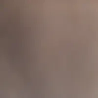0915 066 99 62