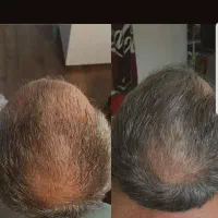نتیجه واقعی رو اینجا میتونی ببینی