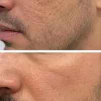 با سلول های بنیادی از بنیاد تغییر کن