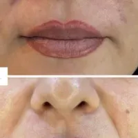 لیزر مو‌- ژل - زیبایی چهره و بدن توسط پزشکان مجرب|خدمات آرایشگری و زیبایی|اردبیل, |دیوار