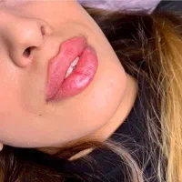 افر استثنایی فیلر بادی،بوتاکس،کانتورینگ،ژل مزوژل|خدمات آرایشگری و زیبایی|تهران, تهرانسر مرکزی|دیوار