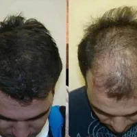 جنگل آمازونش کن