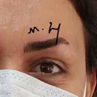 تتو صورت .مزو تراپی پوست ومو ضد لک وروشن کننده