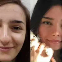 عمل زیبایی جراحی بینی،حداقل قیمت و کادر مجرب