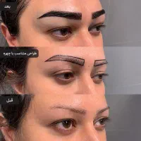 کاشت ابرو - مرکزتخصصی و فوق تخصصی - نرخ دولتی