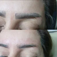 پاک تتو دستگاه پیکوشور گرید A