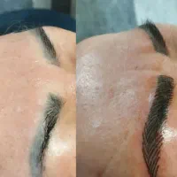 نیازمند مدل‌ میکرو‌بلیدینگ ‌و‌میکروپیگمنتیشن