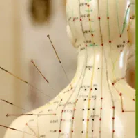 آموزش طب سوزنی در اصفهان/مدرک