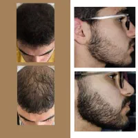 تضمینی بدون بازگشت