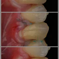 همکاری با مطب تخصصی جراحی لثه درمحدوده میدان آزادی