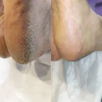 پدیکوردرمانی و اسپا پا در منزل