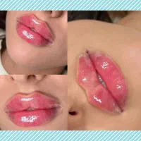 لب روسی،فیلرچشم،بوتاکس‌چشم‌گربه،تخفیف ویژه تابستان