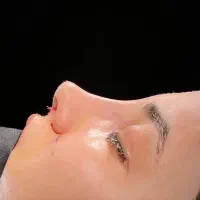 عمل جراحی زیبایی بینی اندام صورت گوش