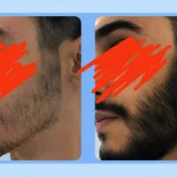 رویش از ریشه زیبایی تا همیشه
