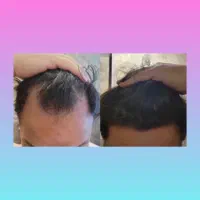 معجزه ریش و مو