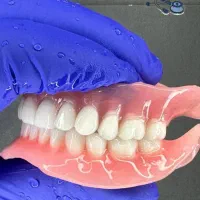 ساخت دندان یک روزه و ضمانتی یزد